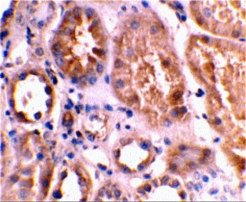 BNIP3L Antibody