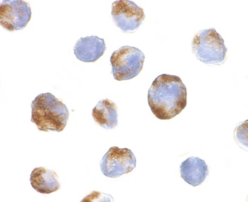 BMI1 Antibody