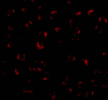 BMI1 Antibody