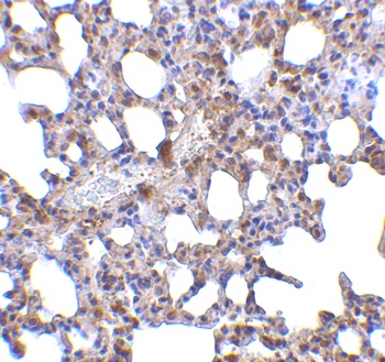 PRDM1 Antibody