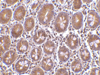 Bit1 Antibody