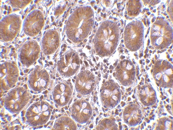 PTRH2 Antibody