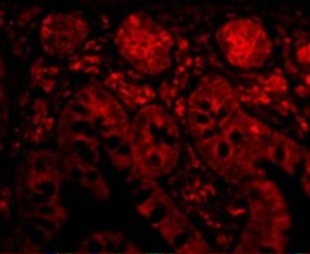 PTRH2 Antibody