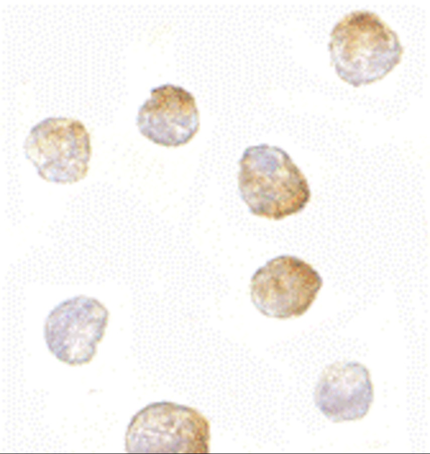 BCL2L11 Antibody