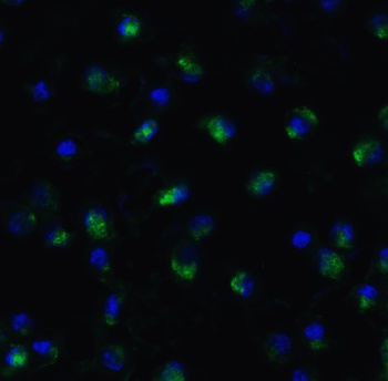 TET1 Antibody