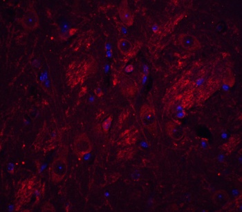 TET1 Antibody