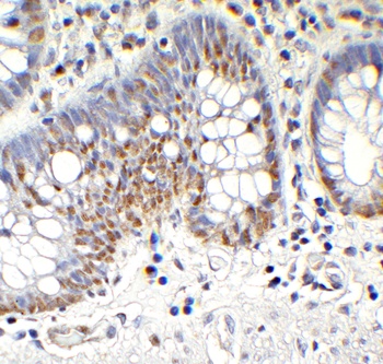 TET1 Antibody