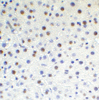 TET1 Antibody