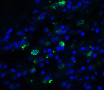 TFF3 Antibody