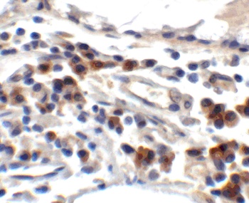 TFF3 Antibody