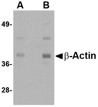 ACTB Antibody