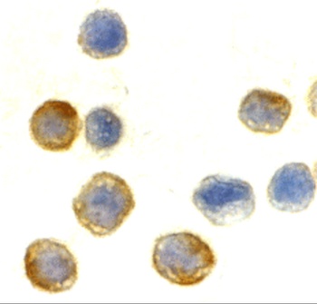 ACTB Antibody