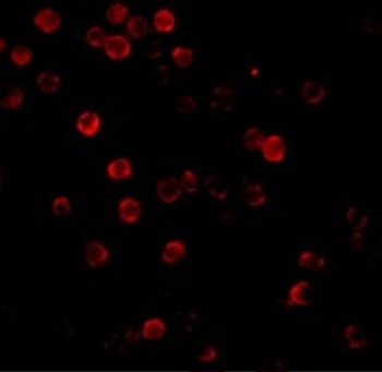 ACTB Antibody