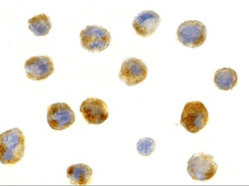 BECN1 Antibody