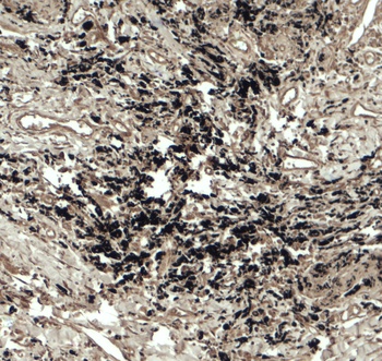 BECN1P1 Antibody