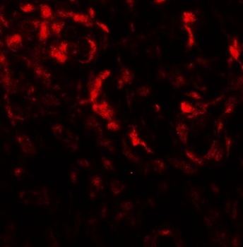BECN1P1 Antibody
