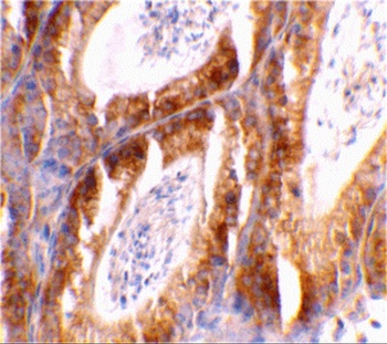 BCL2L14 Antibody