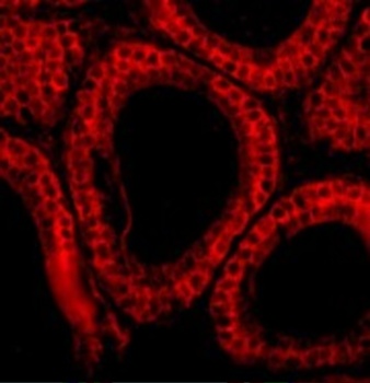 Bcl-G Antibody