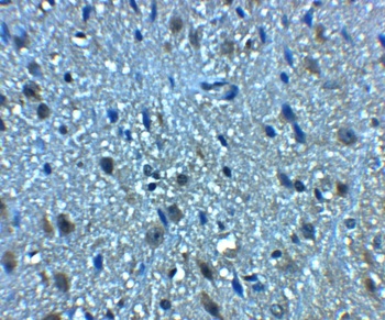 BCLAF1 Antibody