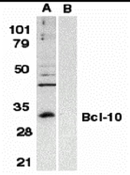 BCL10 Antibody