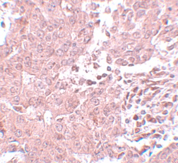 BCAS3 Antibody