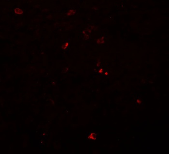 BCAS3 Antibody