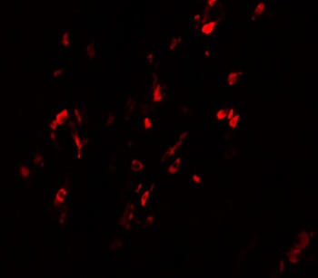 BCAS1 Antibody