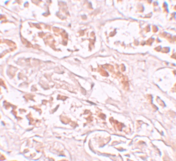 BANP Antibody