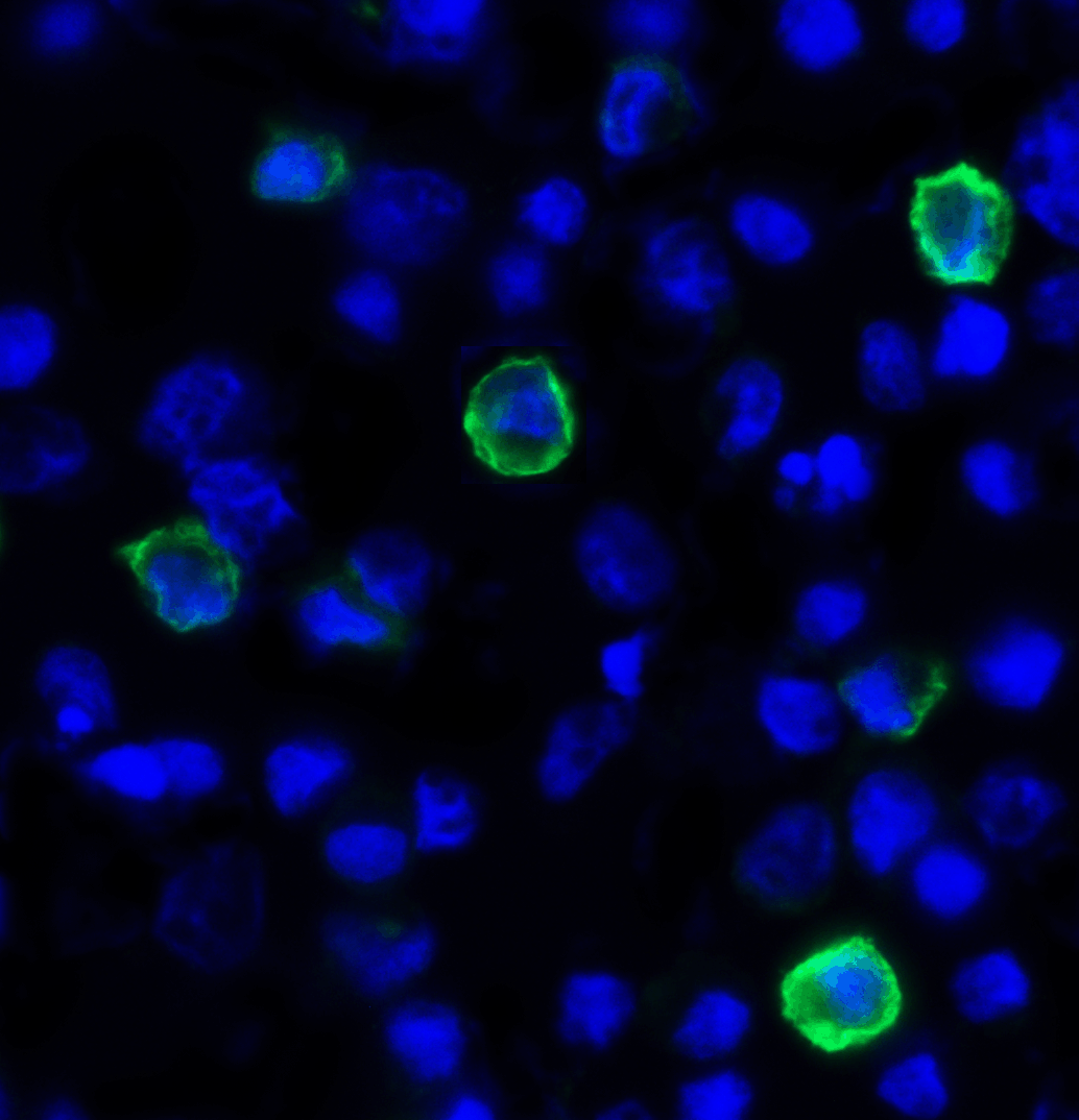 TIGIT Antibody [4A11]
