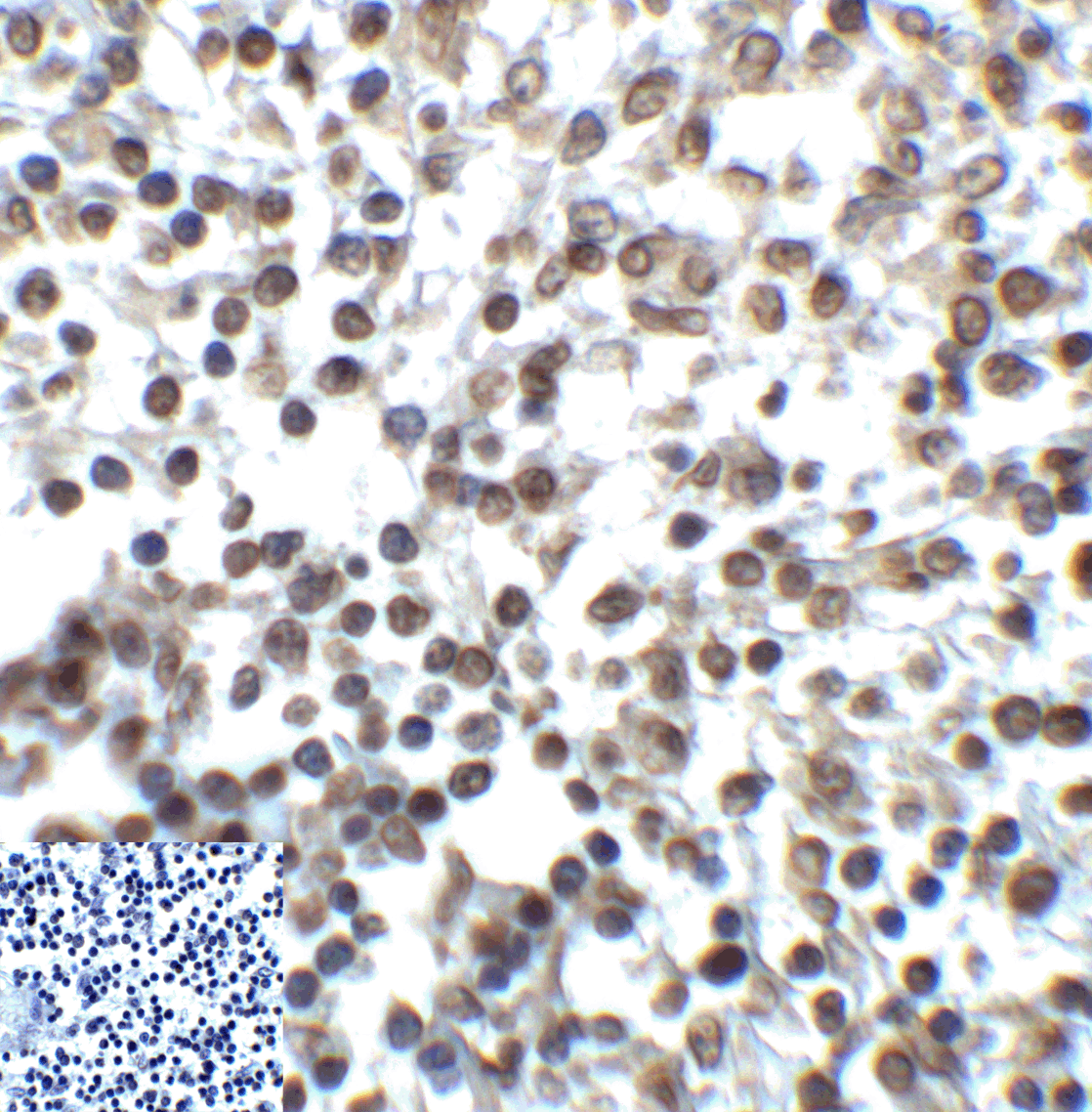 TIGIT Antibody [4A11]