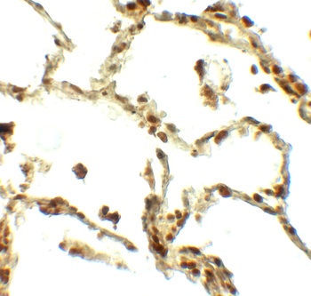 BAMBI Antibody