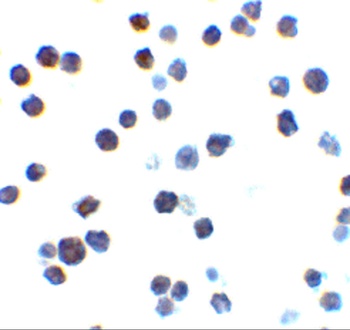 Bak Antibody