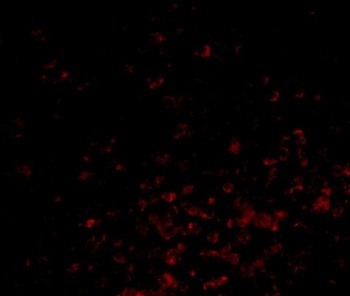 BAG-1 Antibody