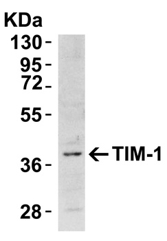 HAVCR1 Antibody