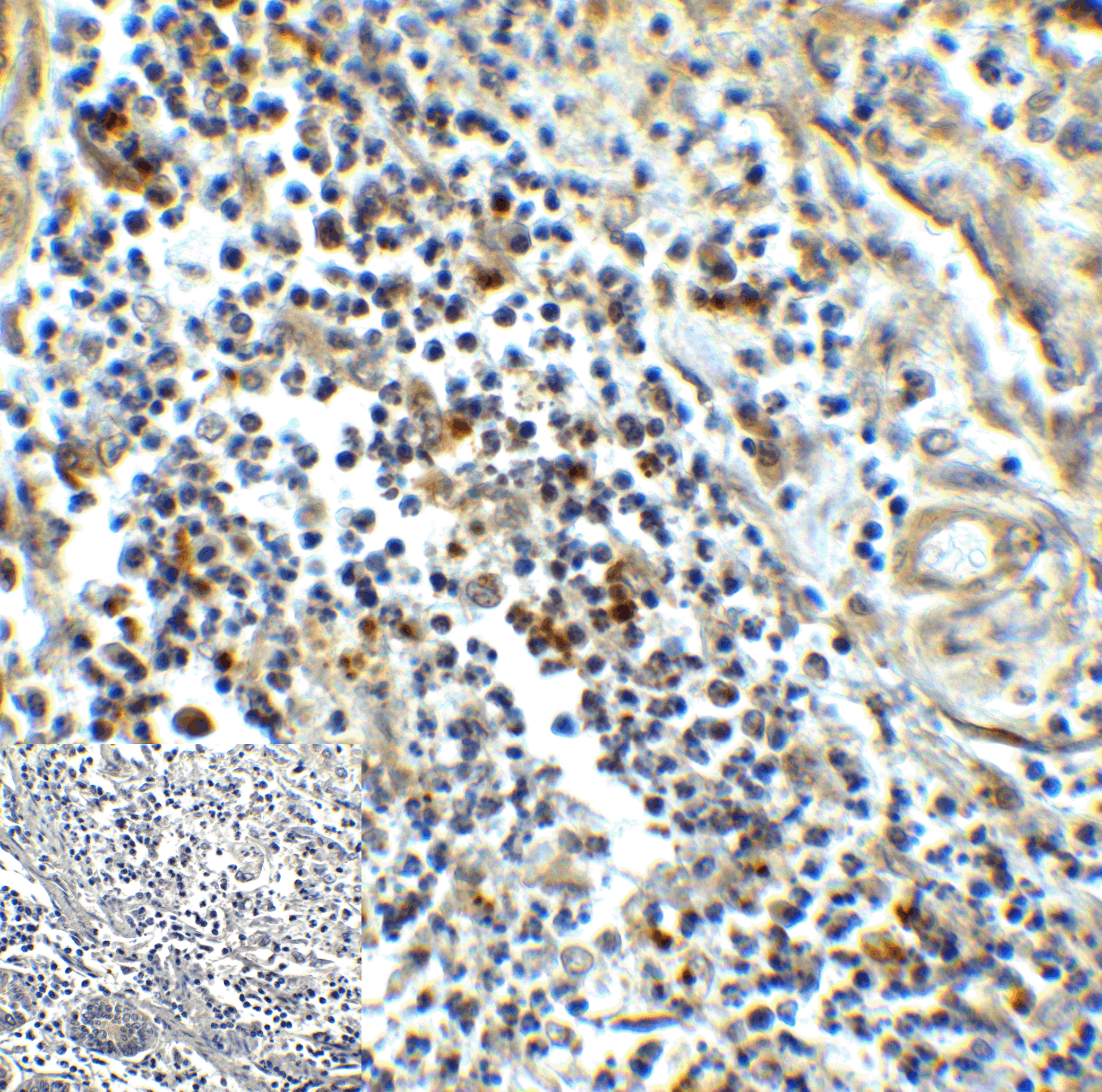 HAVCR2 Antibody