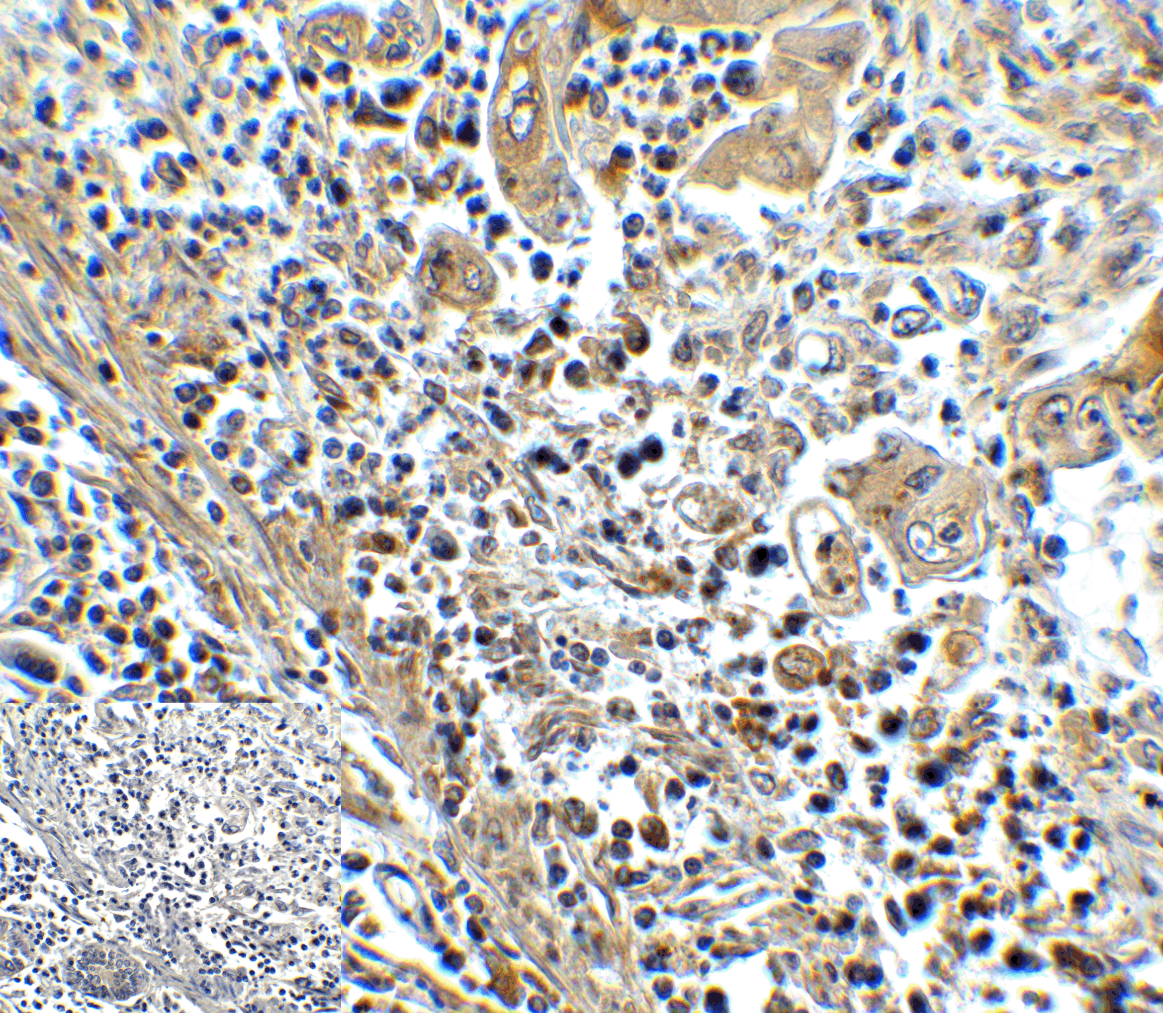 HAVCR2 Antibody