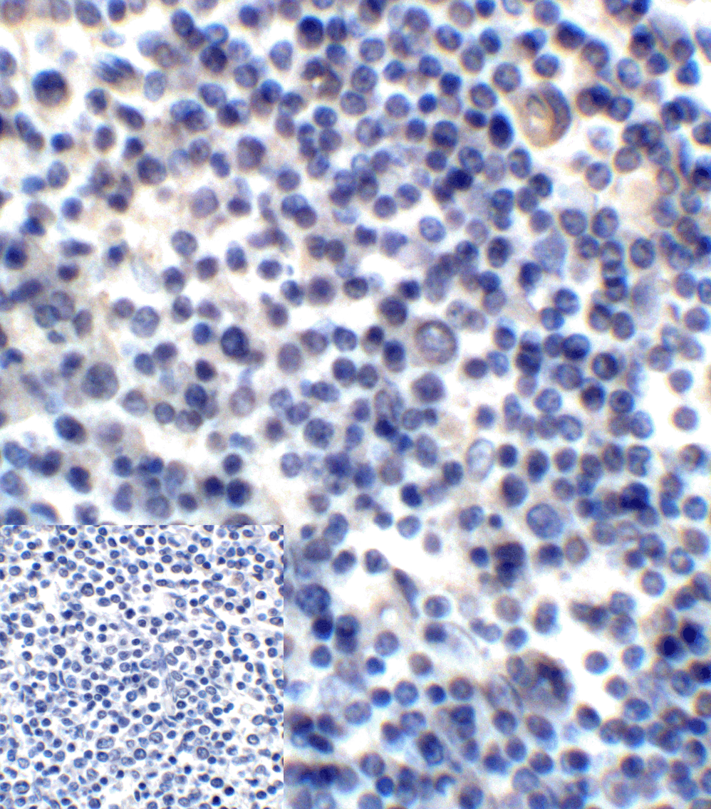 CD276 Antibody