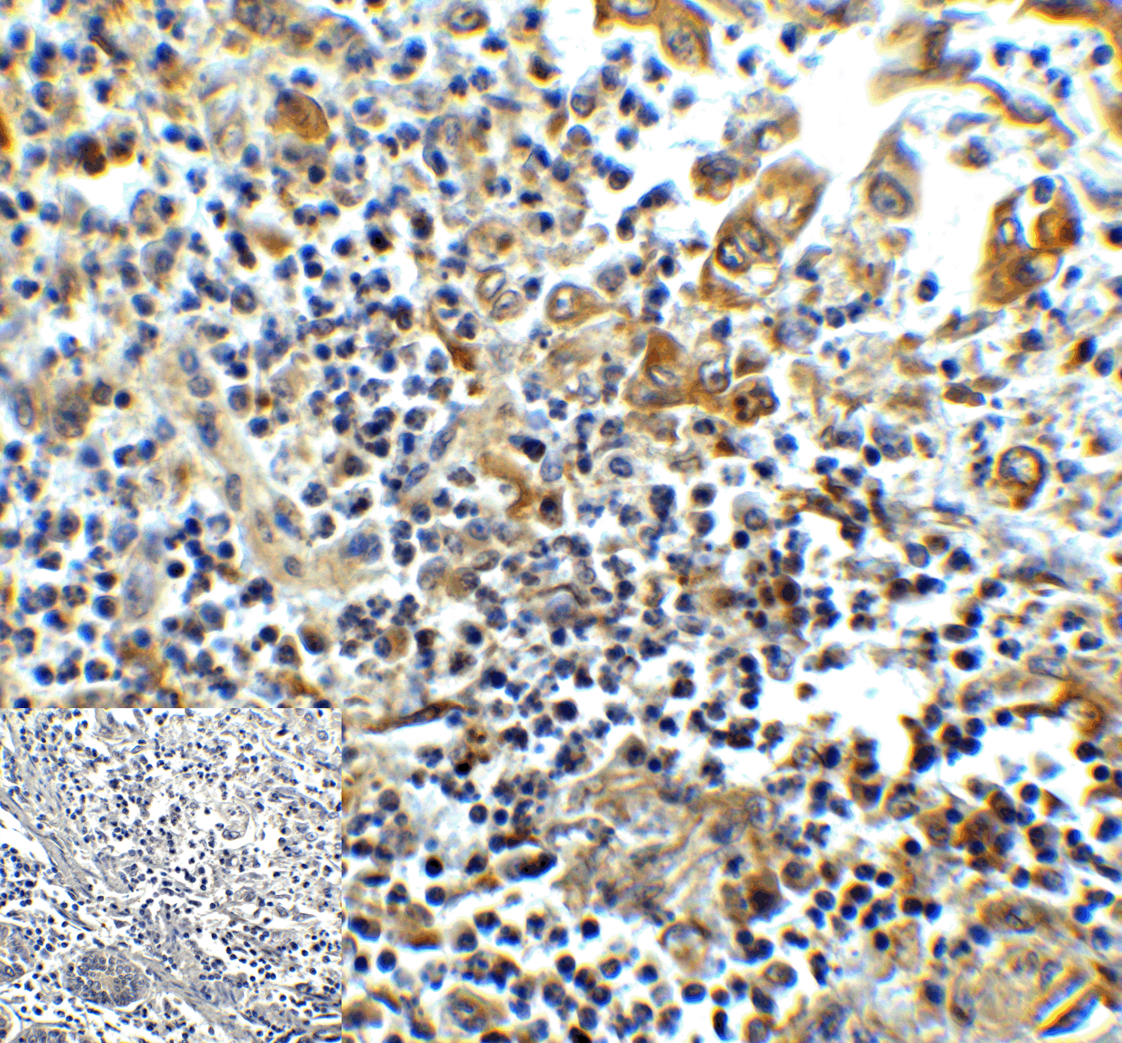 HAVCR2 Antibody