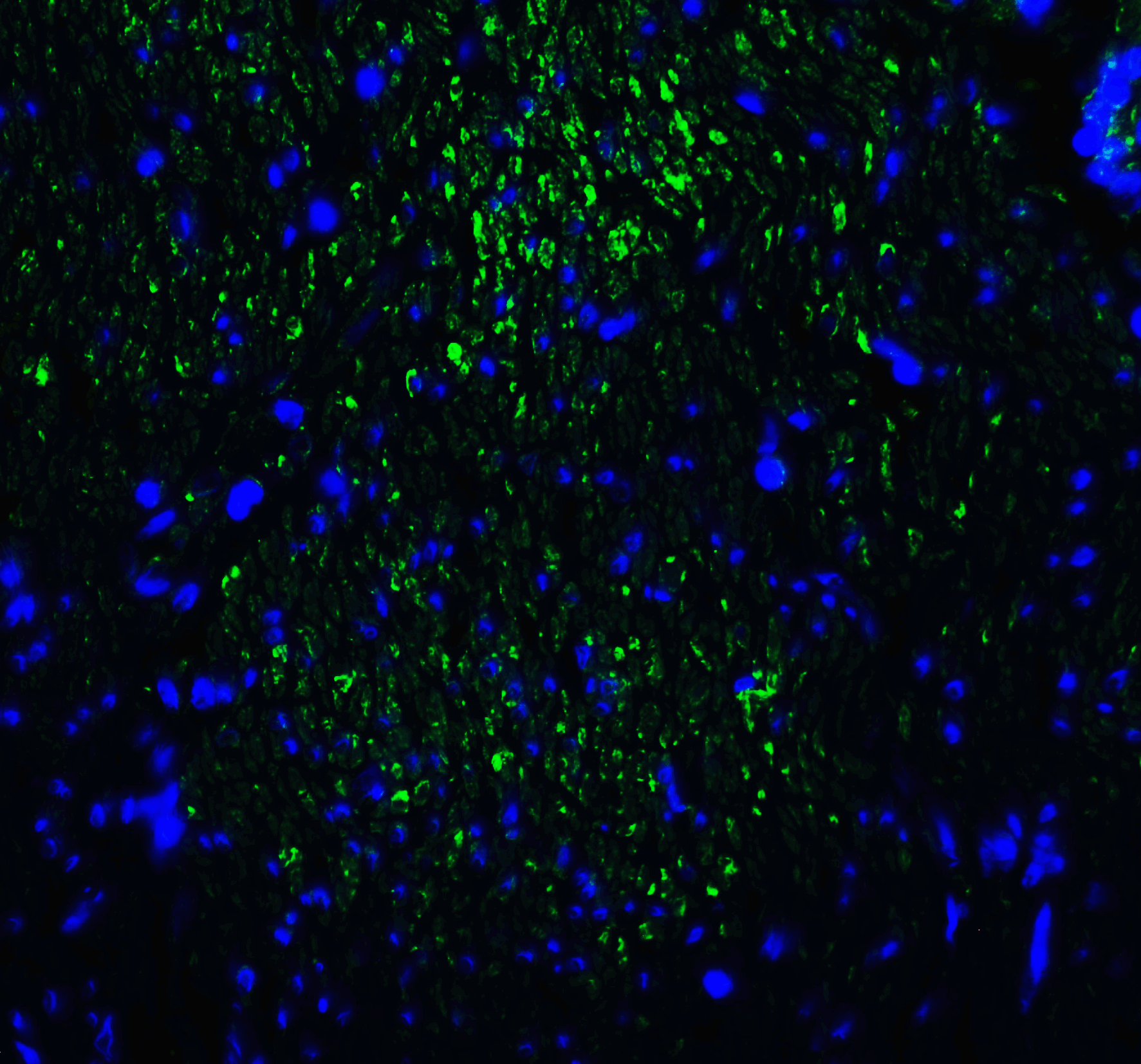 HAVCR2 Antibody