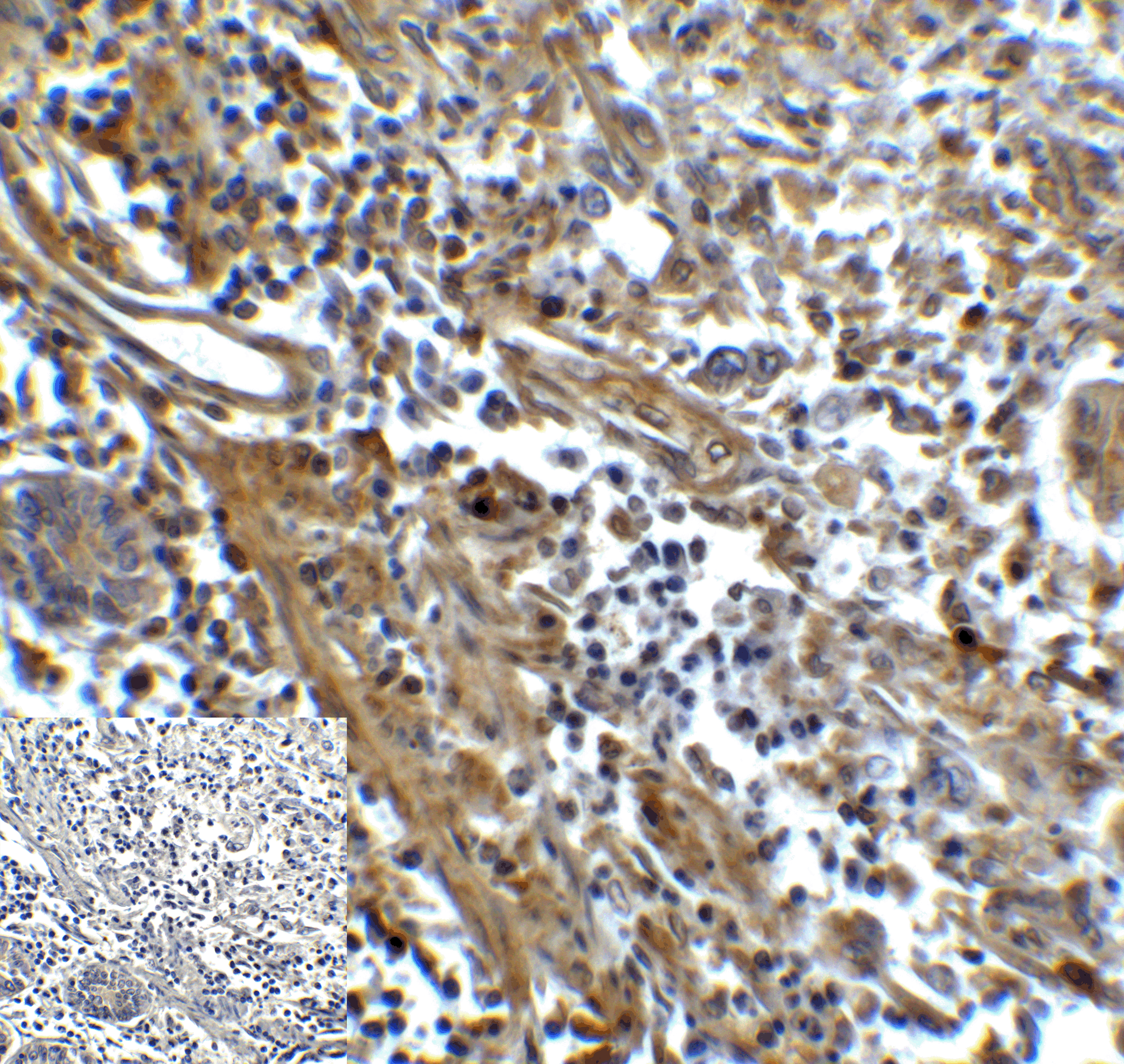 HAVCR2 Antibody