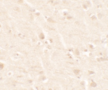 B2M Antibody