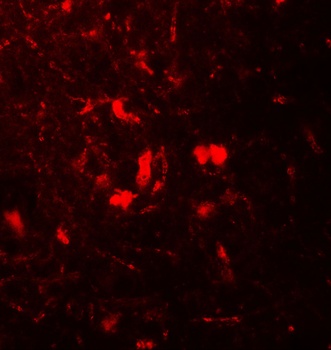 B2M Antibody