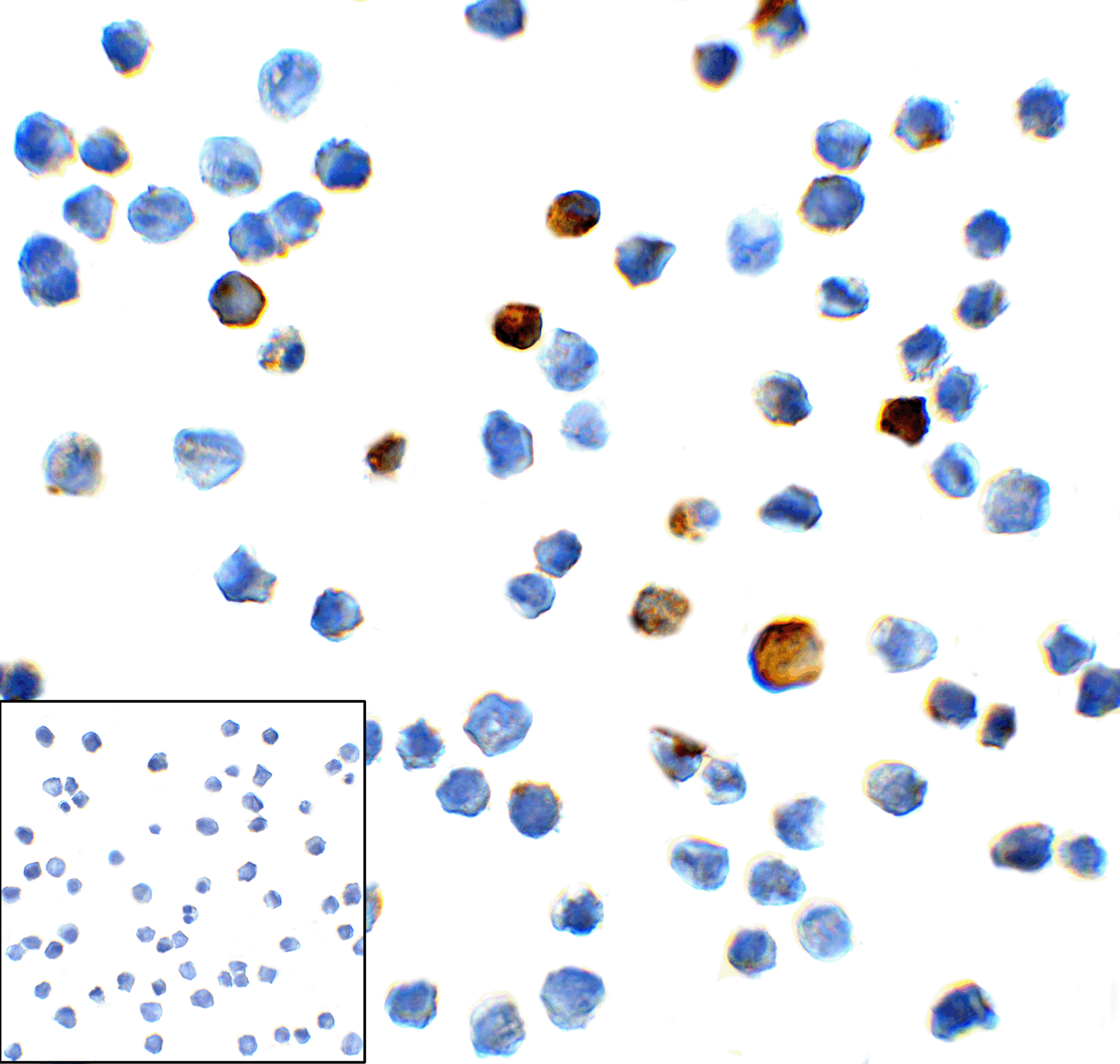 HAVCR2 Antibody