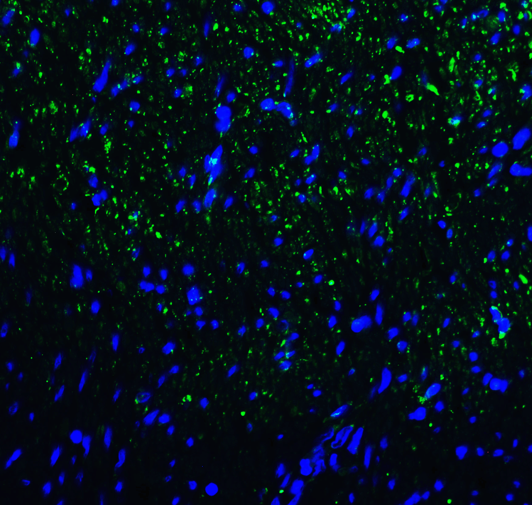 HAVCR2 Antibody