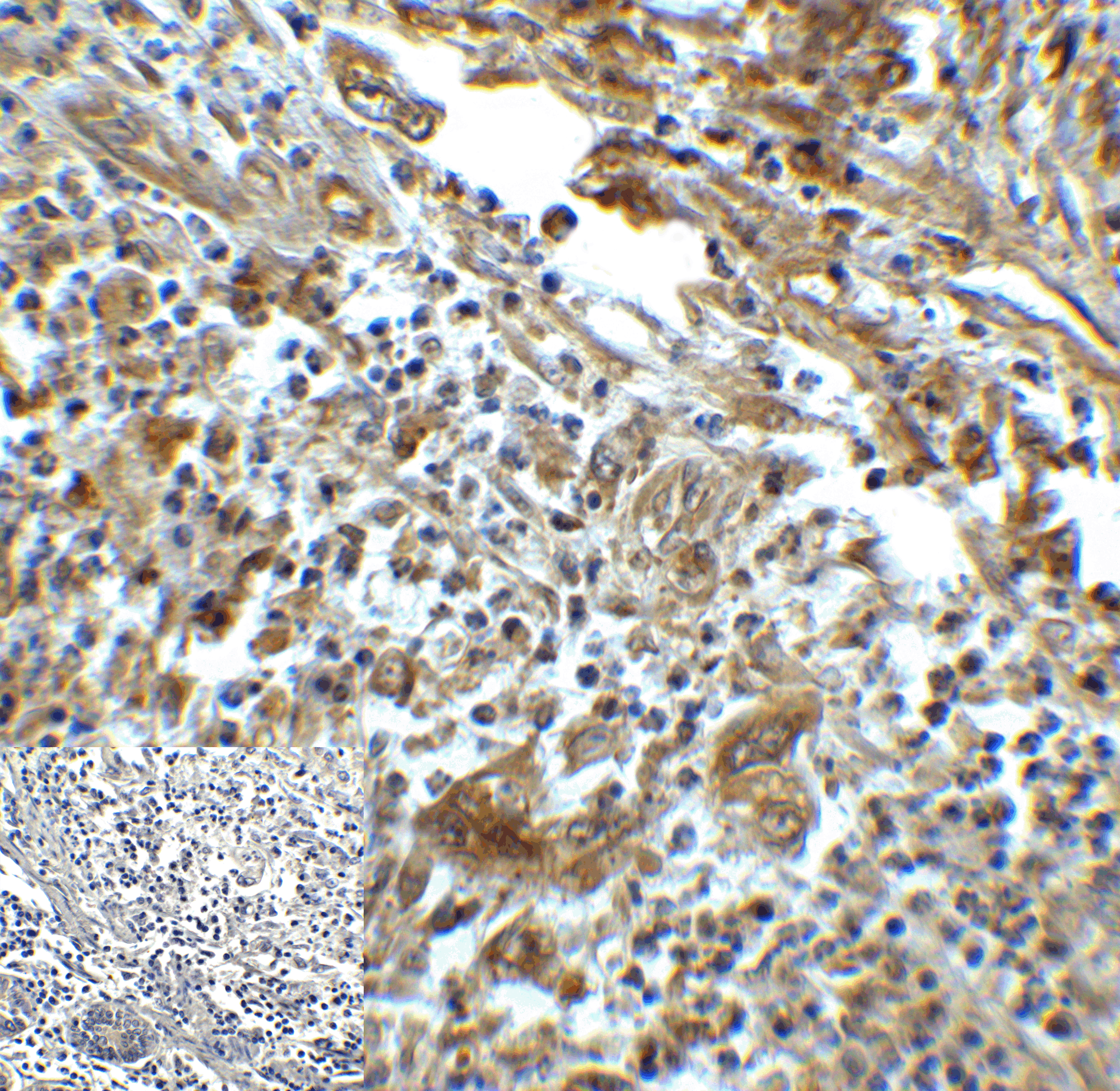 HAVCR2 Antibody