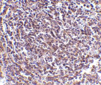 AVEN Antibody