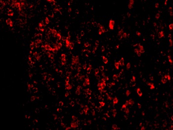 AVEN Antibody