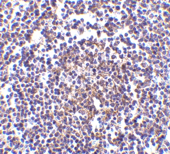 Aven Antibody