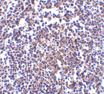 AVEN Antibody