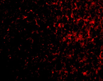 Aven Antibody